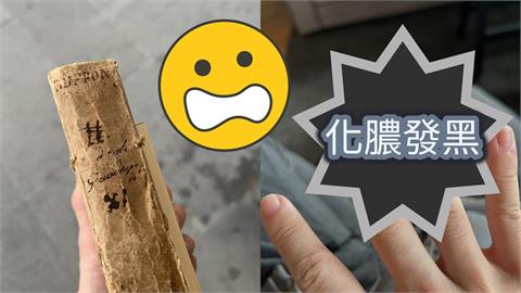 百萬YTR HOOK翻「超臭老書」突冒膿包！奔歐洲醫院「整根發黑」來不及了...