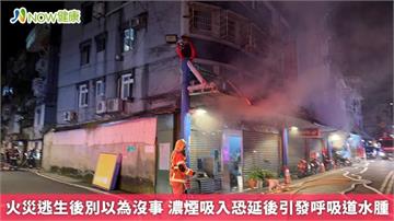 火災逃生後別以為沒事 濃煙吸入恐延後引發呼吸道水腫