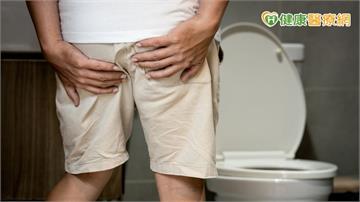 擺脫「座」立難安困擾？醫談雷射痔瘡消融手術（LHP）