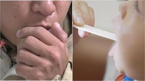 這波新冠症狀多變「3情況」最普遍！狂拉肚子「外加1徵兆」醫示警了
