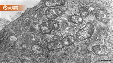 全身起紅疹！男童露營後高燒39度確診恙蟲病