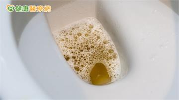 健檢腎功能正常別大意！醫：蛋白尿異常恐是洗腎警訊