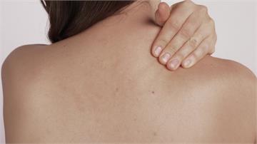 肩膀、手臂刺痛誤以為頸椎神經病變，原來是帶狀疱疹導致  醫揭：疼痛性質不同！