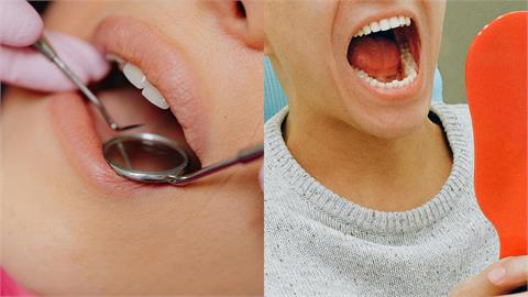 私生活「太激烈全被看光」！牙醫揭「張嘴1細節」漱口也沒用：一看就知道