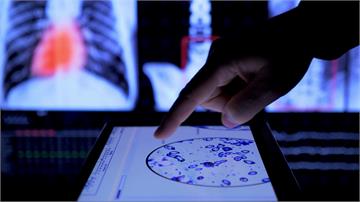 癌症再登國人死因首位！北市今年整合性篩檢起跑，增胃癌與HPV檢測！