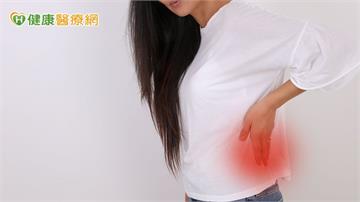 半年腎結石3次！50歲婦雙腎如「葡萄乾麵包」醫曝反覆發作原因