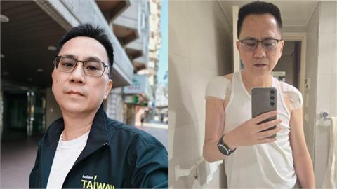 56歲486先生開刀激瘦！一早無預警「衝醫院報到」病況引網憂心：保重
