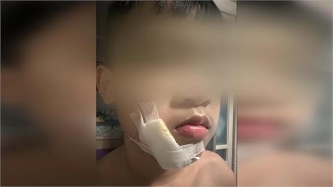 孩遭高年級學生追打　家屬控疑里長家人監視器調不到