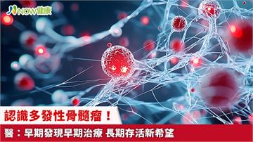 認識多發性骨髓瘤！醫：早期發現早期治療 長期存活新希望