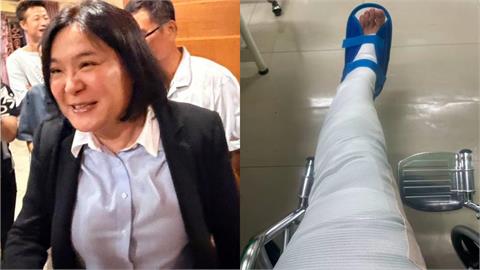 陳玉珍出事了！整條左腿「石膏包緊緊」輪椅照曝光…哀喊：疼痛難耐無法站立