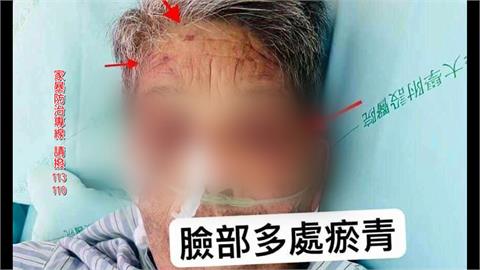 外籍看護狠心毆打臥病奶奶！　家屬求救市長盧秀燕未果民代轟無作為