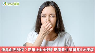 流鼻血先別慌?正確止血4步驟 反覆發生須留意5大疾病