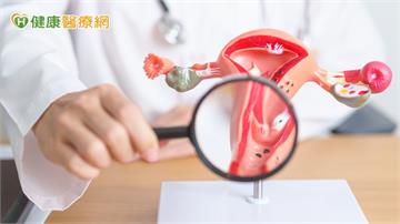 因備孕發現子宮頸癌前病變！醫籲：早期切除才能安心備孕