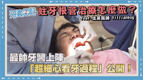 蛀牙下場有多慘？關關公開「根管治療」全過程　網驚呼：起雞皮疙瘩