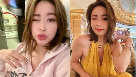 許維恩沒家族病史也會得乳癌？醫揭「高風險族群」：早期幾乎不會痛