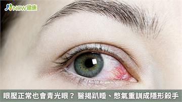 眼壓正常也會青光眼？ 醫揭趴睡、憋氣重訓成隱形殺手