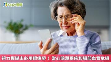 視力模糊未必用眼疲勞！ 當心暗藏眼疾和腦部血管危機