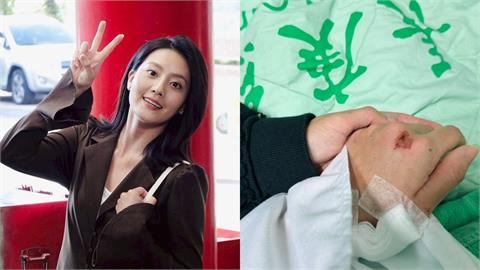 顏曉筠遭汽車「撞飛倒地」傷勢嚴重急動手術！嘆按下暫停鍵《好運來》後續動向曝