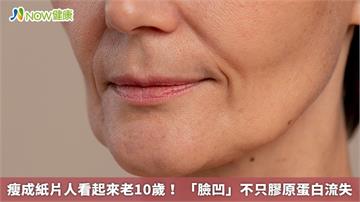 瘦成紙片人看起來老10歲！ 「臉凹」不只膠原蛋白流失