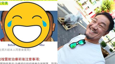 醫美模特「對比照外流」竟是陳為民！「打碼無效」秒被認出網笑：2張都before？