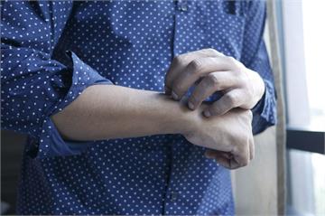 每年平均復發9次！   她罹異位性皮膚炎「傷口緊黏衣物扒不開」