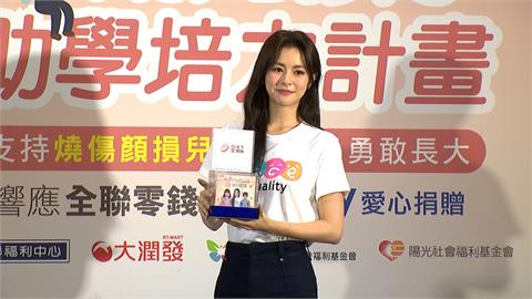 任容萱響應超市零錢捐　任愛心大使助燒傷顏損兒