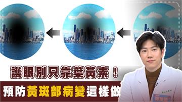 視野變形、直線扭曲？小心黃斑部病變！保護眼睛從這「三招」做起