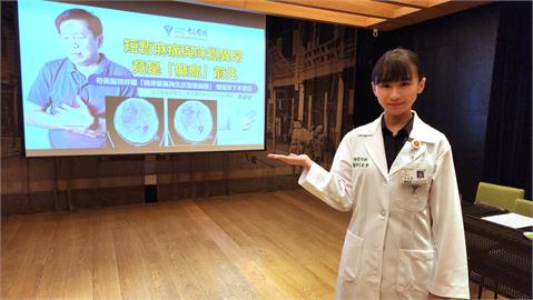 癲癇症狀多元　短暫麻痛與味覺異常也是發作前兆