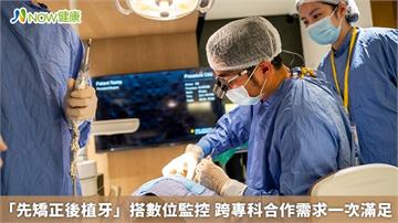 「先矯正後植牙」搭數位監控 跨專科合作需求一次滿足