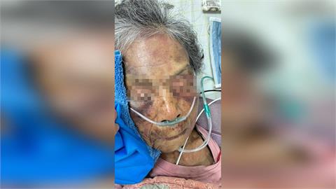快新聞／90歲也打得下去？屏東37歲逆孫狂毆嬤　家人怒罵「畜生」