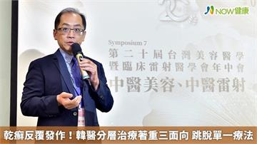 乾癬反覆發作！韓醫分層治療著重三面向 跳脫單一療法