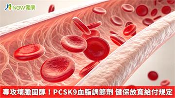 專攻壞膽固醇！PCSK9血脂調節劑 健保放寬給付規定