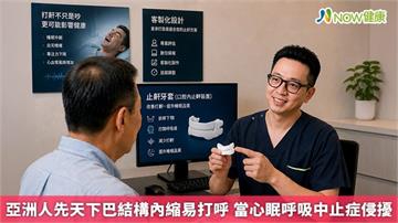亞洲人先天下巴結構內縮易打呼 當心眠呼吸中止症侵擾