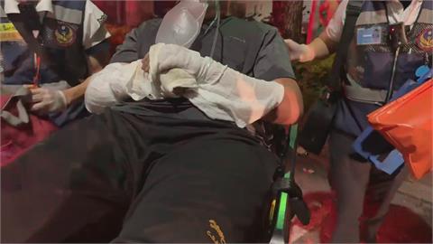 鋰電池充電突爆炸起火！屋內姊弟手臉、頭髮被炸傷