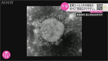 日本靜岡3人無出國史 遭確診感染英國變異病毒