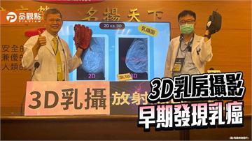 高雄榮總9年追蹤研究  3D乳房攝影提升乳癌早期診斷與存活率