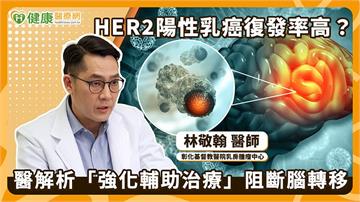 HER2陽性乳癌易腦轉移　高風險群可依情況進行「多一年治療防線」