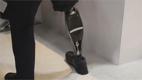 AI智慧義肢超強！　截肢者「健步如飛」　沒問題