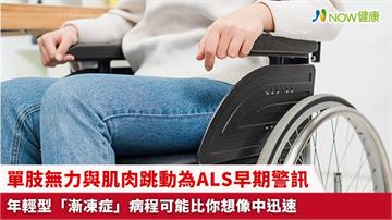單肢無力與肌肉跳動為ALS早期警訊 年輕型「漸凍症」病程可能比你想像中迅速