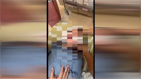 又傳狗咬人！2歲男童遭黑狗撲倒狂咬　臉多處撕裂傷急送醫救治