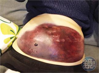 代孕名人爆斂財2／人妻拿命拚胚胎託付她後卻失蹤　吳素慧還要人違法假結婚