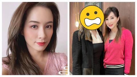 47歲香港佳麗真實現況曝！「整頭光禿＋凸肚」崩壞狀態網嚇壞