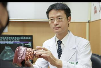 熟女沒症狀健檢卻「零期肝癌」！   國人4成肝癌其實二狀況意外發現