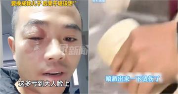 保溫杯倒入「剛燒開熱水」打開噴出　男子灼傷眼部險釀意外