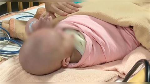 雲林保母疑不當對待！　4個月早產嬰「顱內出血」醫示警