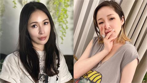 蕭亞軒突發全黑圖！認1年半內「開了4次刀」：這是什麼樣的生活