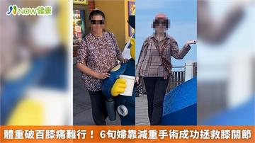 體重破百膝痛難行！ 6旬婦靠減重手術成功拯救膝關節