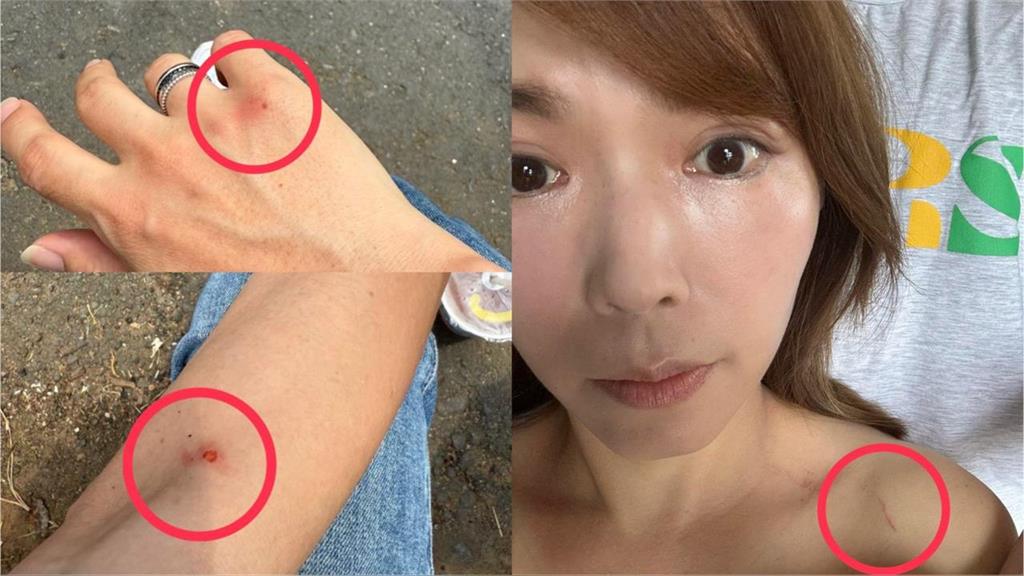 快新聞/陳智菡PO走讀受傷照 控警逼改道「總統府變天安門了嗎?」