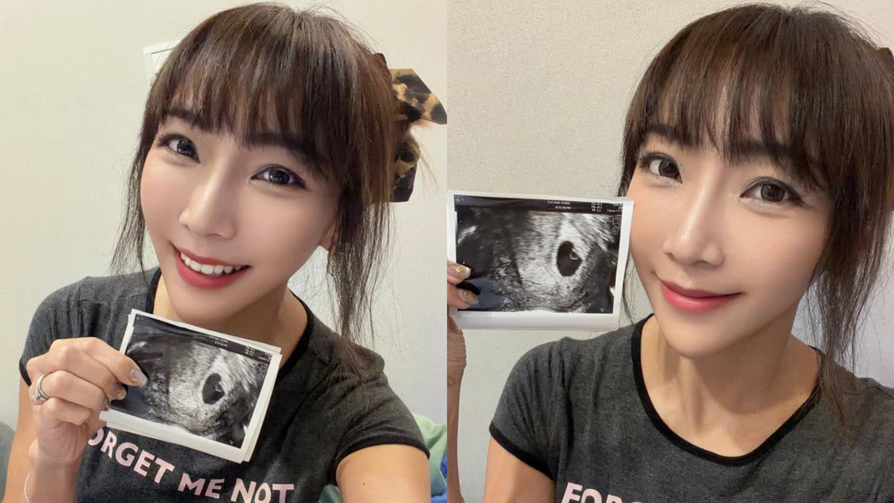 42歲資生堂千金懷「第6寶」！首度自然懷孕驚呼：人生巨大驚喜