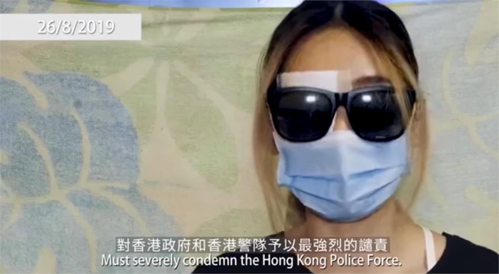 影／「希望我的右眼讓香港遠離痛苦」反送中爆眼女子出面譴責警隊意圖謀殺港民